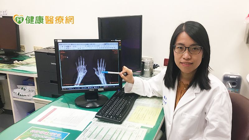 類風濕性關節炎積極就醫 超商店員圓夢當上店長