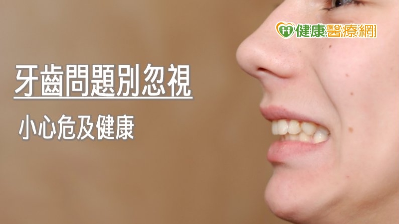 糖尿病易有口腔疾病 牙齒清潔、檢查不可少