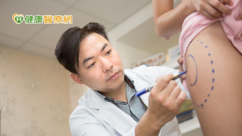為明年春夏做好準備! 關於冬天抽脂好處你不可不知