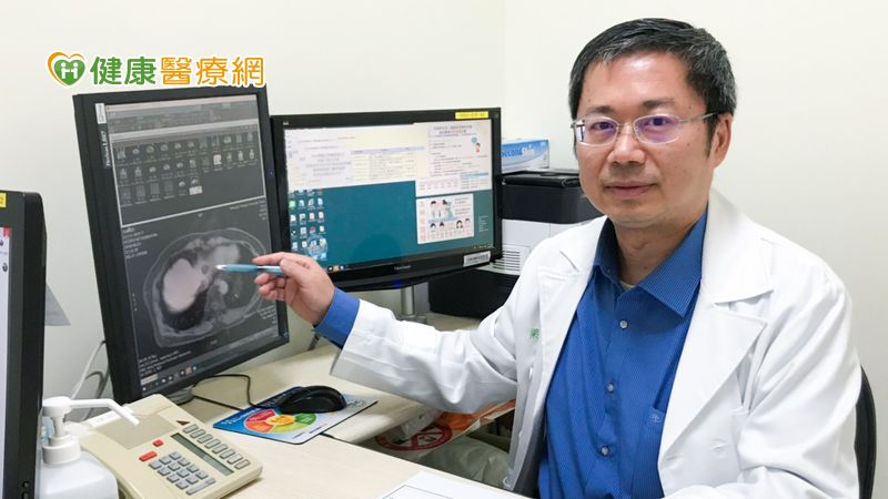肝臟標靶型顯影劑 讓小型肝癌無所遁形