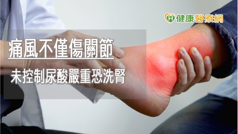 痛風不僅傷關節　未控制尿酸嚴重恐洗腎