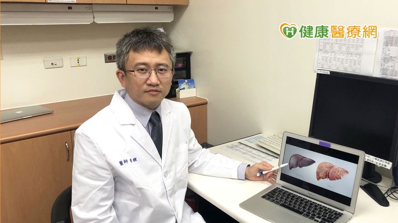 小型肝癌檢測不易 MRI搭配標靶型顯影劑提高準確率