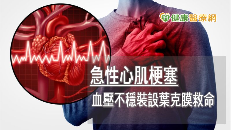 急性心肌梗塞併發二尖瓣腱索斷裂　葉克膜成功救回一命