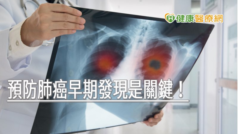 預防肺癌早期發現是關鍵! 成大醫院員工607名篩檢21人確診