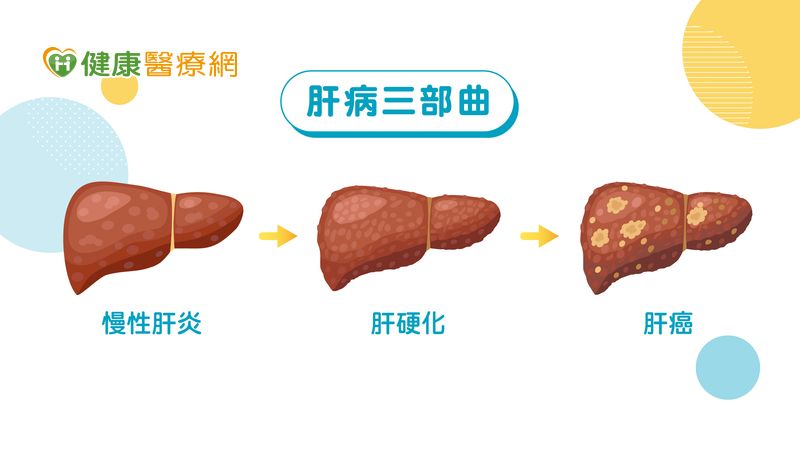 B肝帶原是隱形的殺手? 罹肝癌風險高出150倍