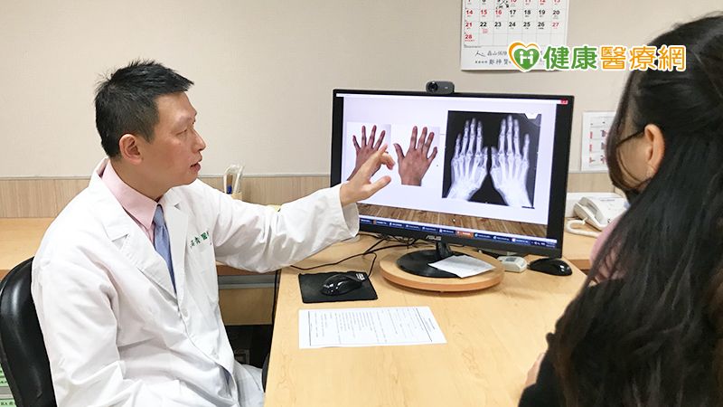 關節疼痛無法握筆寫字 竟是類風濕性關節炎上身!