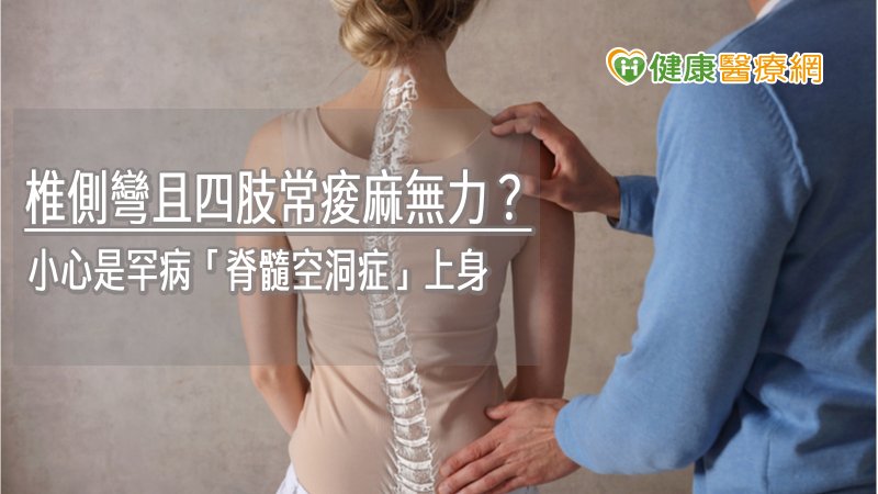 脊椎側彎且四肢常痠麻無力? 小心是罕病「脊髓空洞症」上身