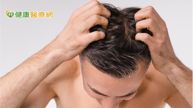 頭上出現紅皮疹以為濕疹 竟是癌前病變