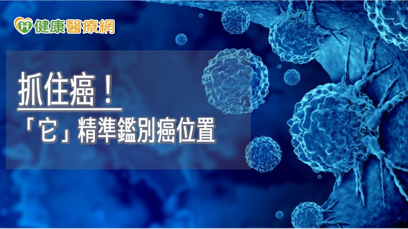 抓住癌! 「氟18去氧葡萄糖」精準鑑別癌位置
