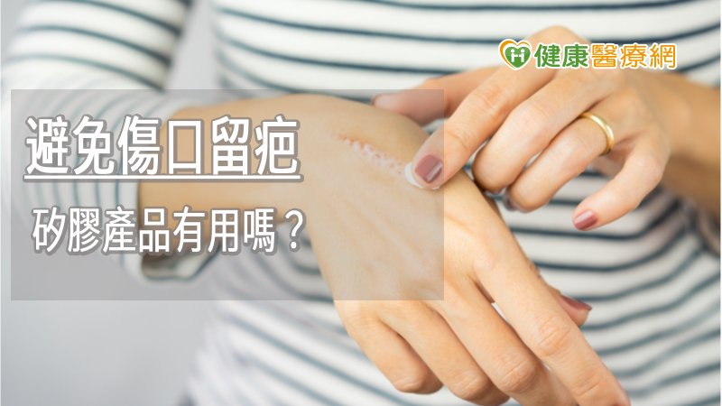 避免傷口留疤 矽膠產品有用嗎?