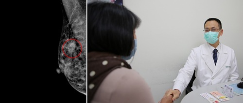 量身打造治療計畫 乳癌病友重拾自信生活/波新聞