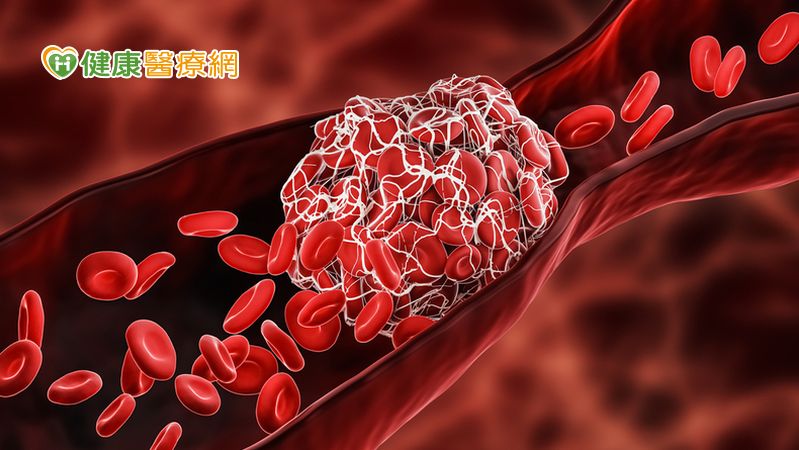 宅在家不運動氣血不通 手腳麻中醫籲活血多動