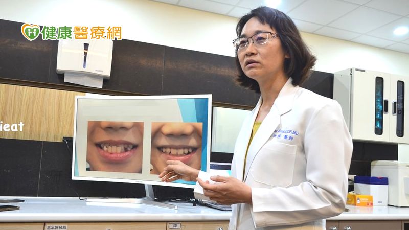 牙齒亂等長大再矯正? 醫師籲:『有幾種情況,矯正不能等!』