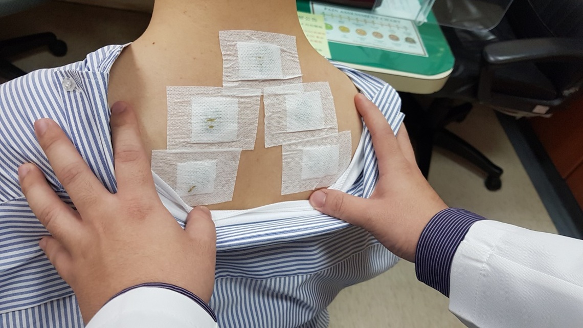 嘉基中醫部推出改良版「三伏貼」增強免疫功能/波新聞