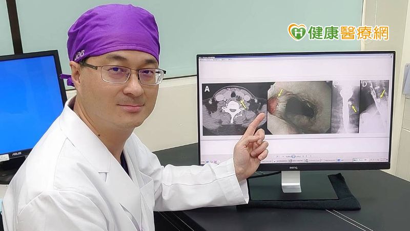 喉嚨卡卡還異常反芻 竟是食道憩室作怪