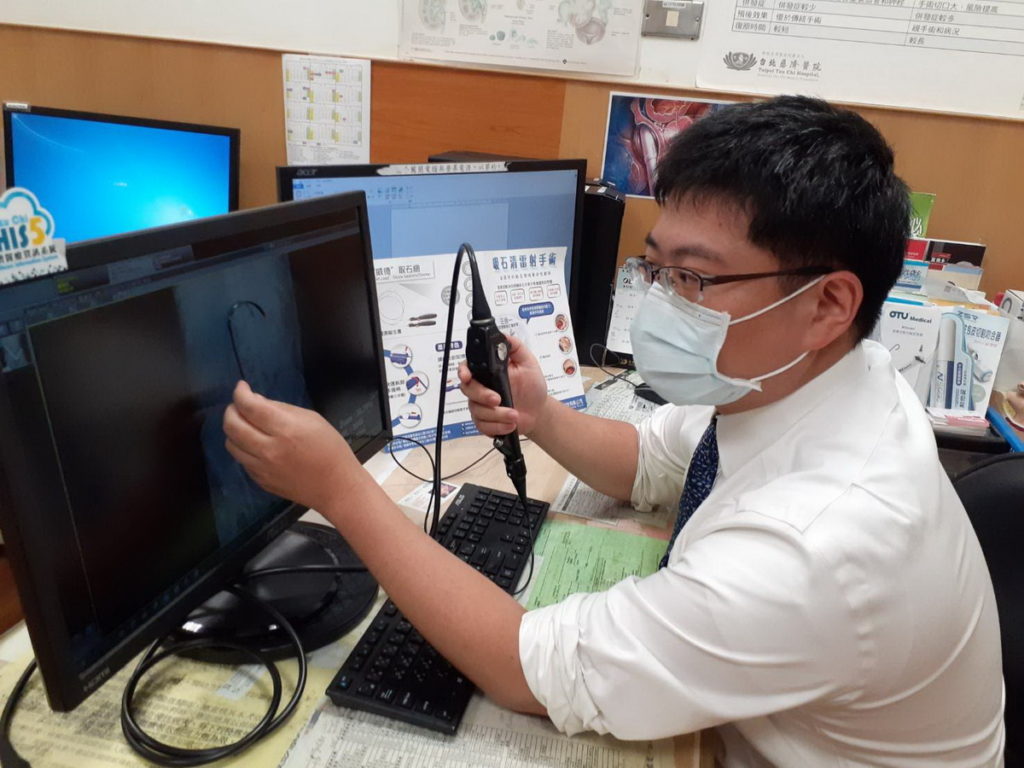 許竣凱醫師表示,2歲病患因為採用新式軟輸手術的專利吸石清導管,成功清除結石。