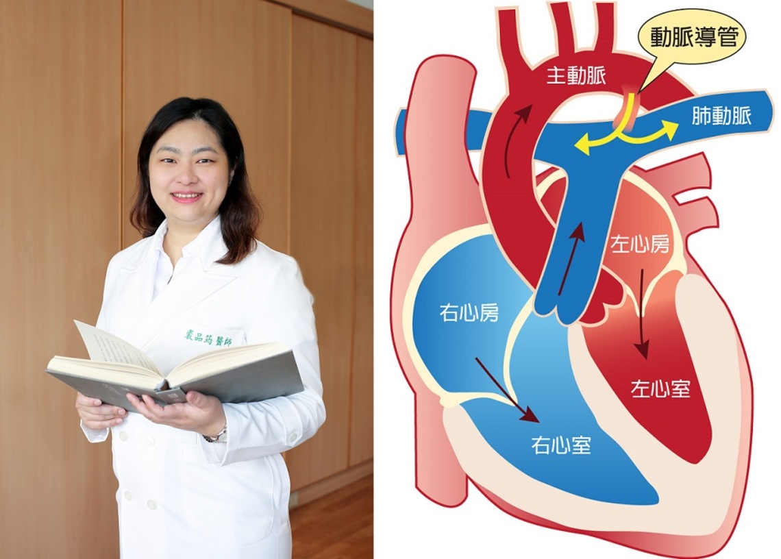 小兒開放性動脈導管 心導管手術成功助二歲童恢復健康/波新聞