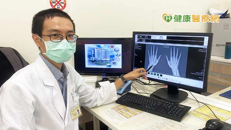 類風濕性關節炎纏身 險害烘焙師夢碎!