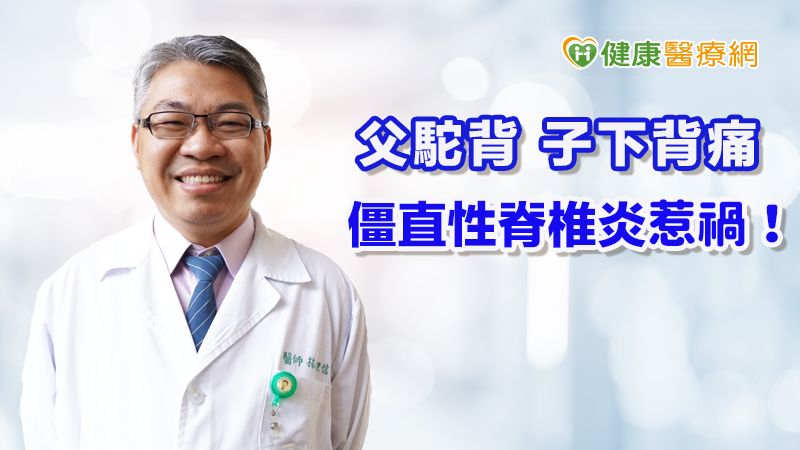 父駝背 子下背痛 僵直性脊椎炎惹禍!