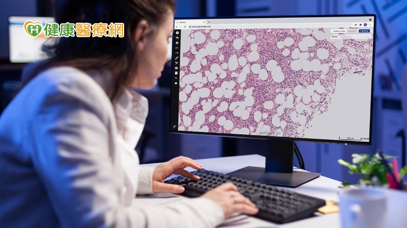 摸不到的「骨髓增生性腫瘤」 導入AI精準揪出兇手