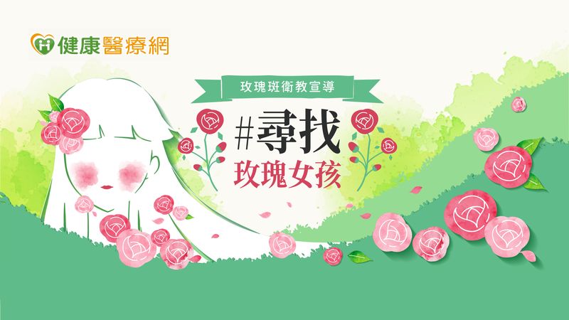臉紅、冒痘易忽視 藝人舒子晨以親身經驗呼籲重視玫瑰斑