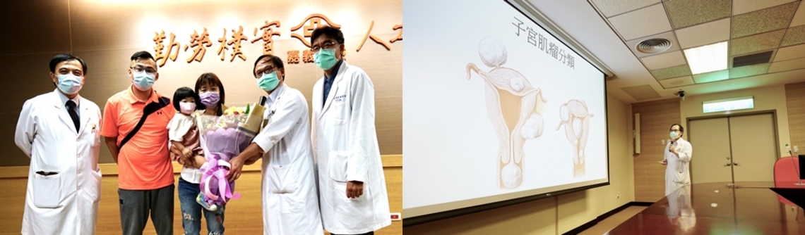 子宮肌瘤微創手術 嘉義長庚醫院助高齡婦女喜獲寶寶