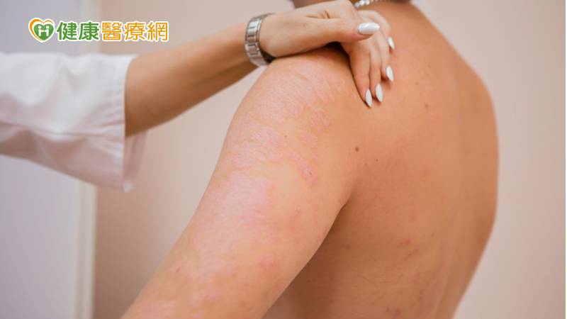 自體免疫疾病早期難診斷 國衛院找到關鍵致病因子