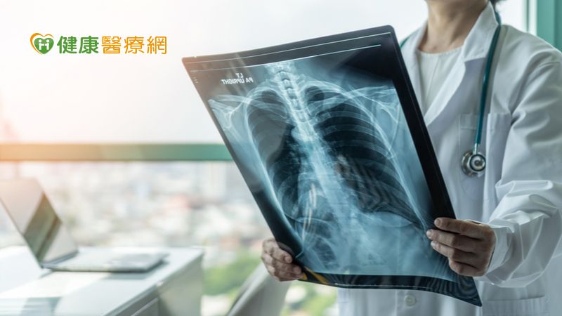 莫名喘咳竟是晚期小細胞肺癌 免疫組合治療燃生機