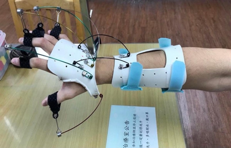 中風患者偏癱影響生活　動態副木提升手功能恢復