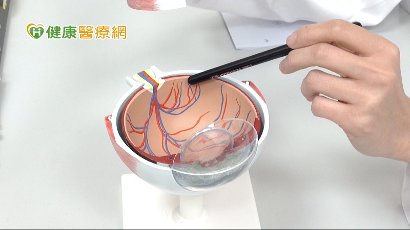 小心黃斑部病變! 不可忽視的眼睛癌症