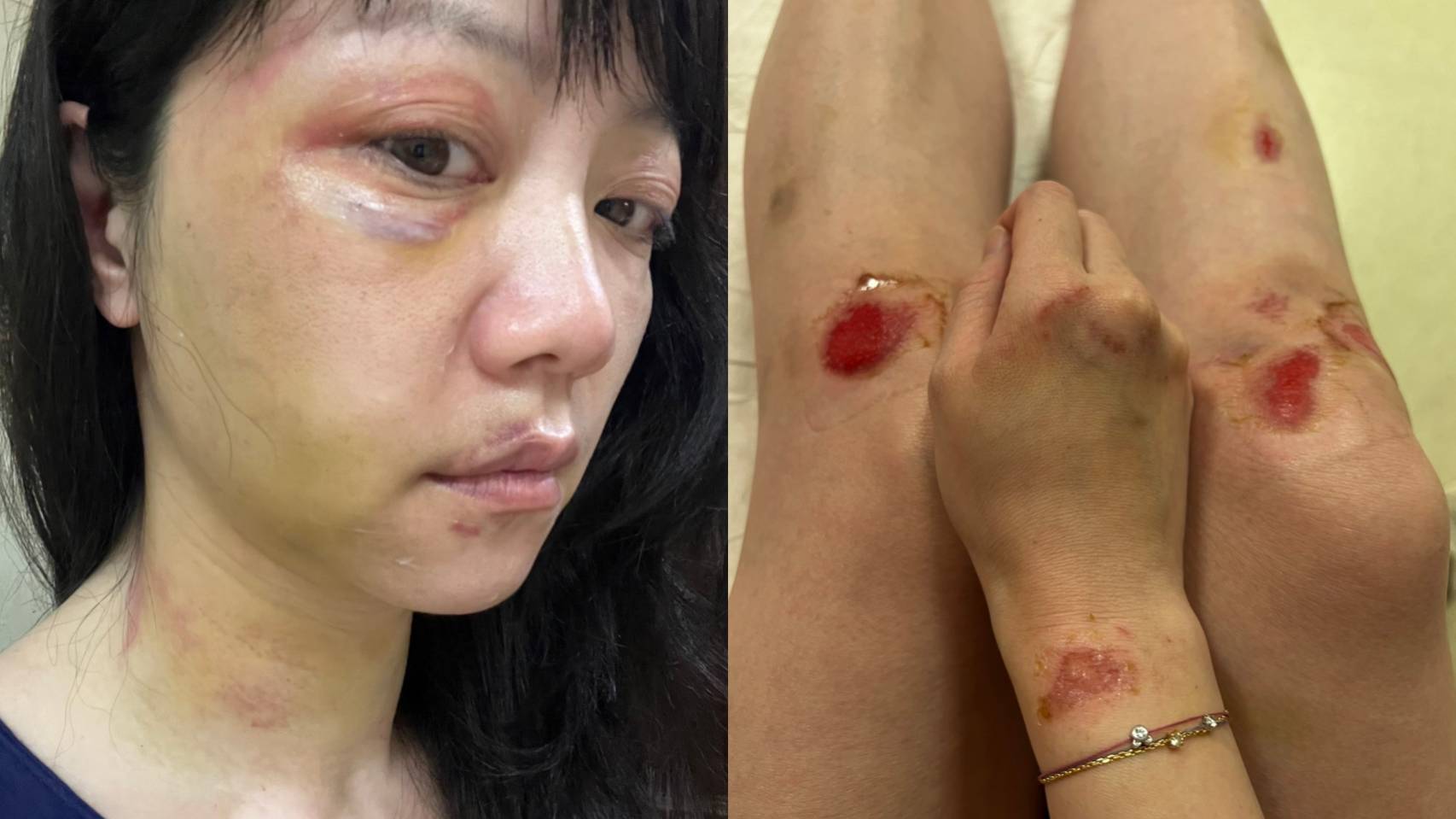 林秉樞案/朱學恆、郭正亮均點名賴清德 應出面聲援高嘉瑜 78 1150763 2