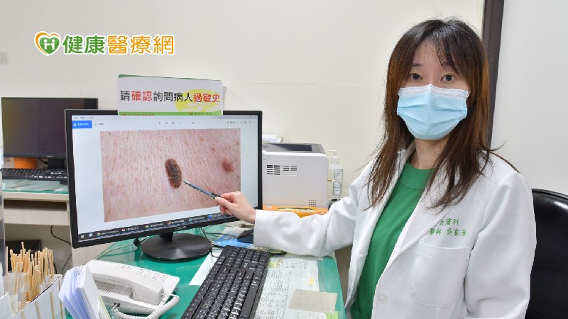 臉上斑點好討厭 皮膚科醫:冬季正是除斑好時機