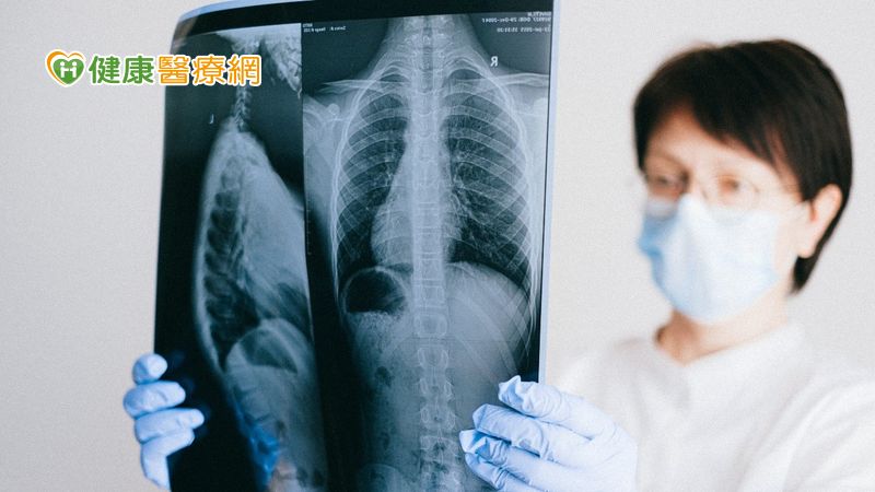 選標靶還是免疫? 個人化精準醫療掌握肺癌治療先機