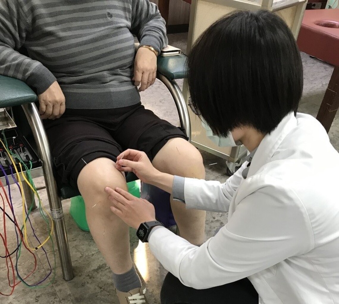 台南市醫中醫針灸緩解膝關節炎免開刀