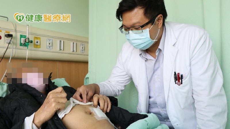 6旬翁衣服下緣濕透以為湯打翻 就醫一看竟是腹水