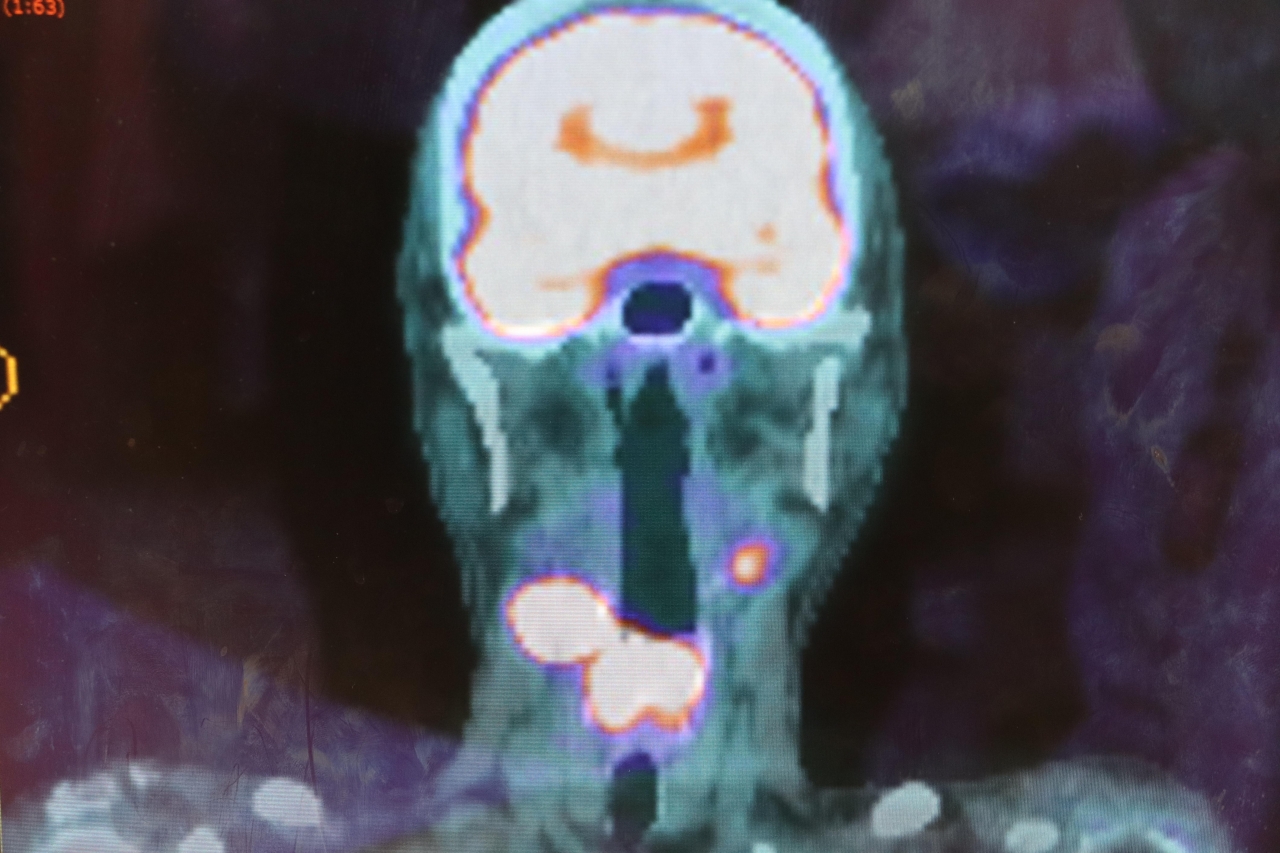 202201191735571CSa