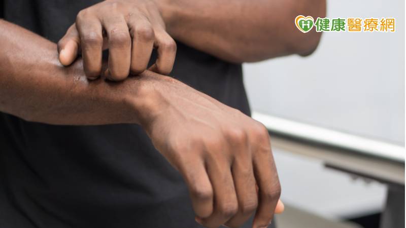 冬天皮膚乾癢難耐泡熱水舒緩? 小心症狀加劇