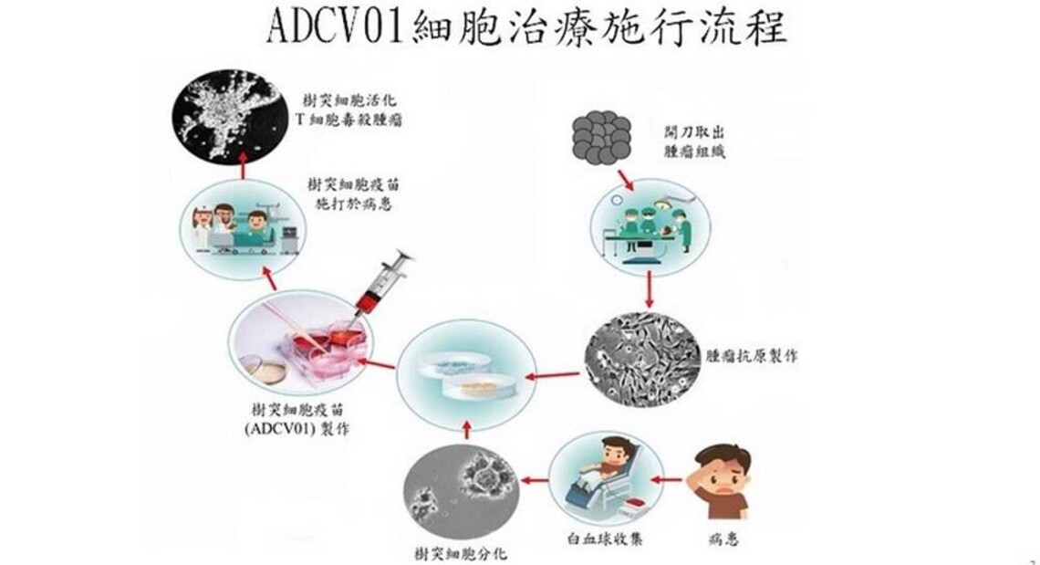 安醫細胞治療助癌友免出國求診
