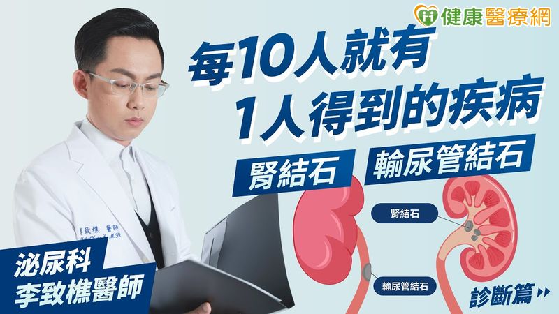 花生粒大的「腎結石」險要命 醫:恐有年輕化趨勢