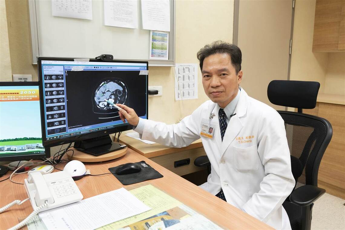 早期診斷 化被動為主動 翻轉肝癌治療關鍵