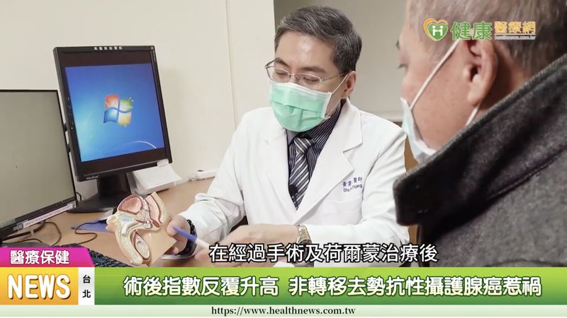 攝護腺癌治療新選擇 新型抗荷爾蒙口服藥物延長存活期