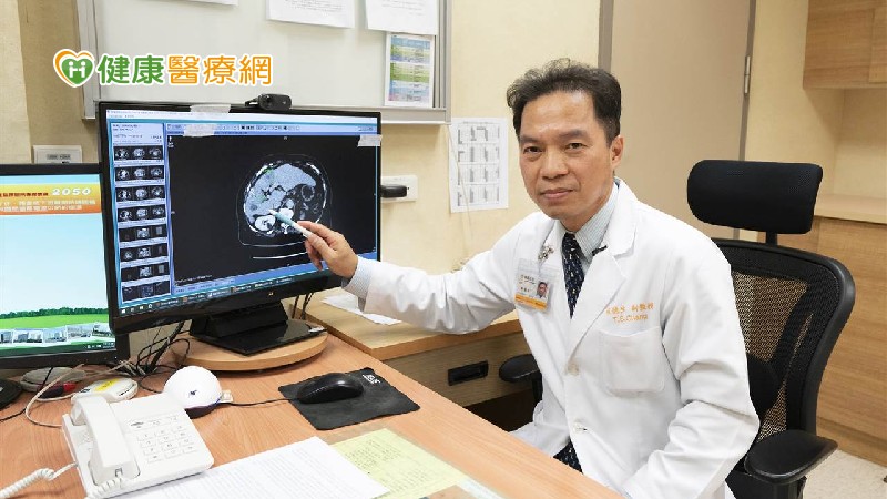 主動篩檢病毒性肝炎 翻轉肝癌治療關鍵