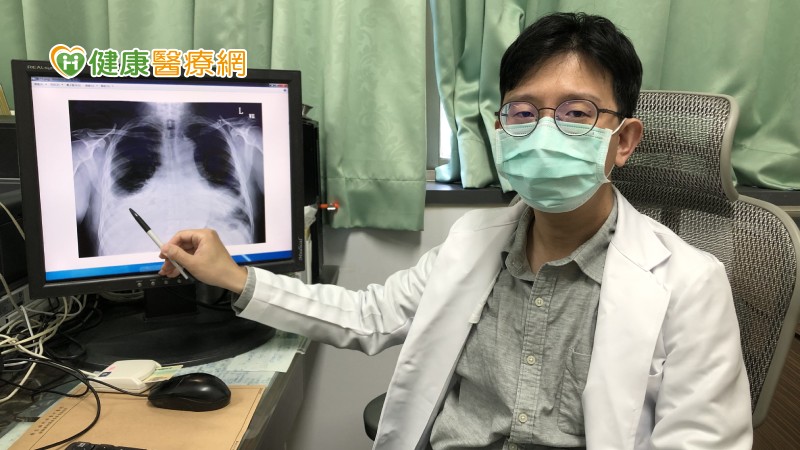 呼吸胸痛又反覆高燒 當心是胸腔內蓄膿