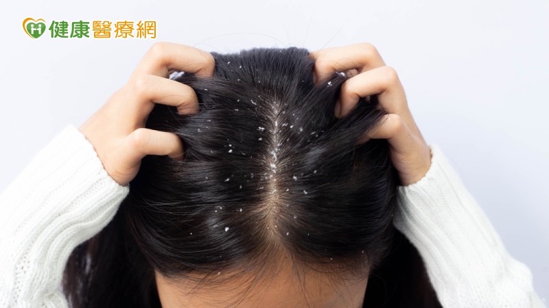 頭皮屑、頭皮油、落髮 三大頭皮問題讓人出門好尷尬