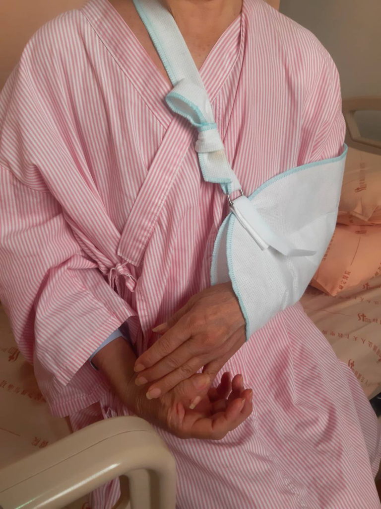 治療後的患者蔡女士