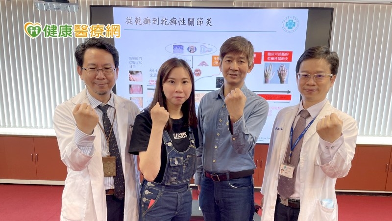 不到一年乾癬變乾癬關節炎 中榮共同照護提升生活品質
