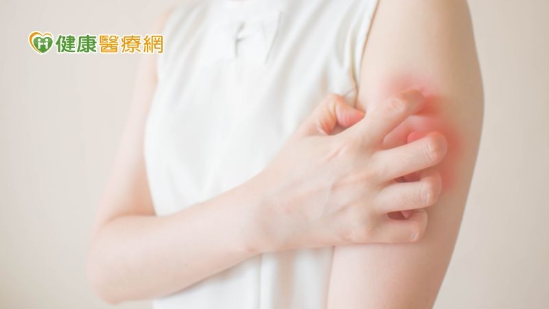 健保給付難申請 中重度異位性皮膚炎患者身心俱疲