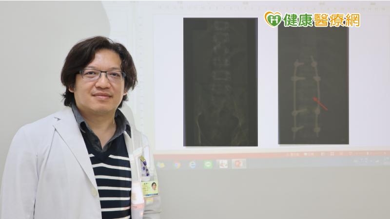 男墜下水道OHCA 葉克膜搶回一命 化解癱瘓危機