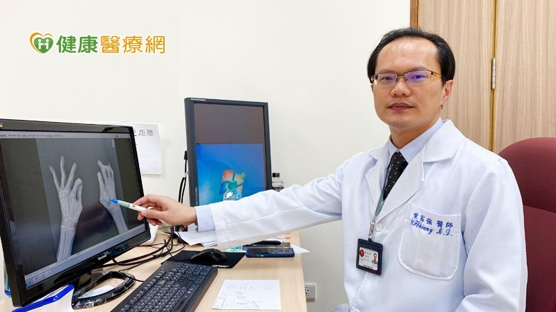 積極治療類風濕性關節炎 遠離併發症失能危機