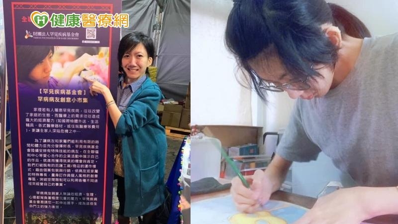 【罕病孤獨路5】害怕不被社會接納 一個關鍵讓她勇敢